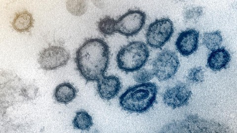 В Сколково научились уничтожать коронавирус